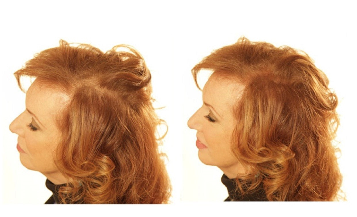 Before and after of a red haired woman with bald spots, using KeraFiber hair building fibers.